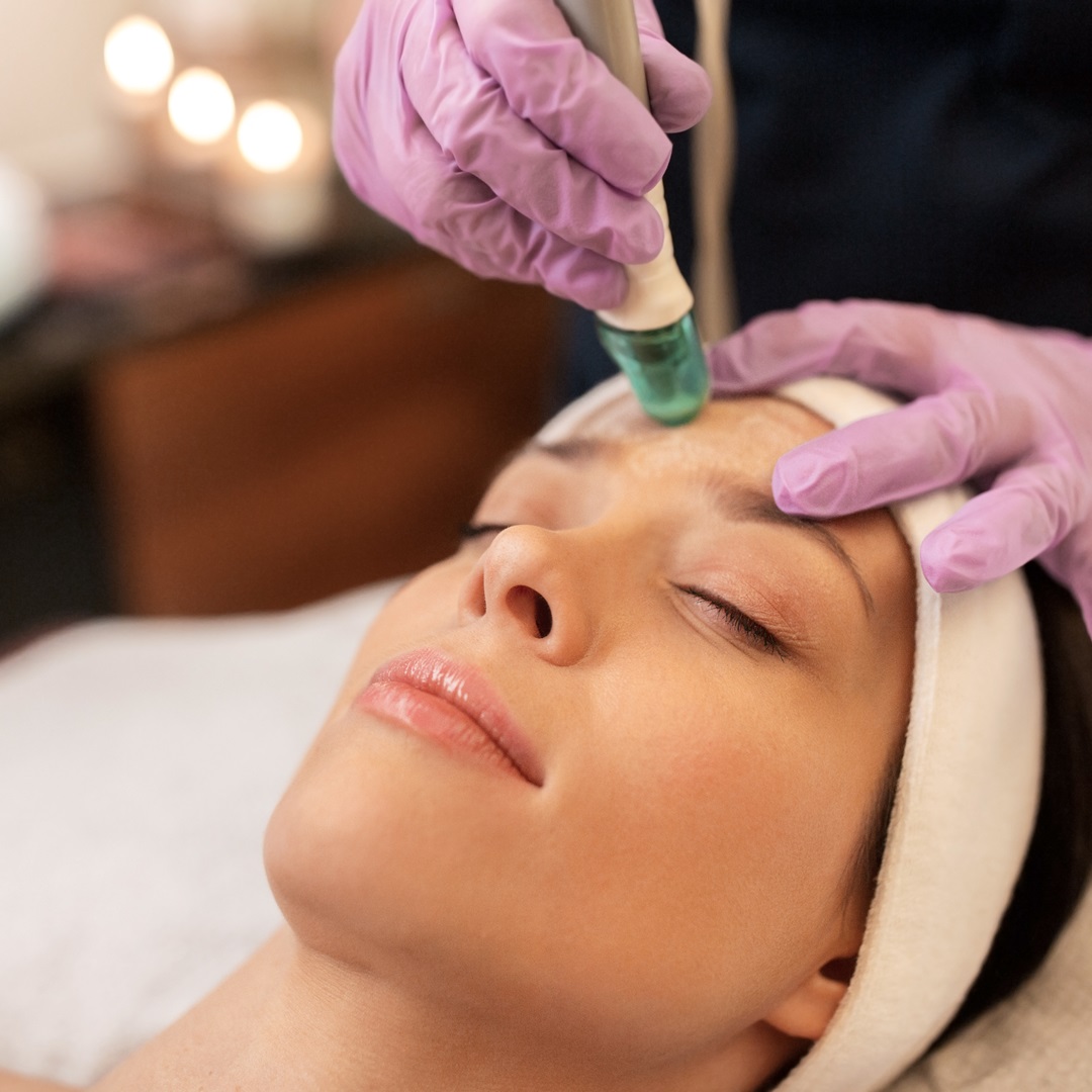 Achieve Radiant Skin with Microneedling and the Vampire Facial